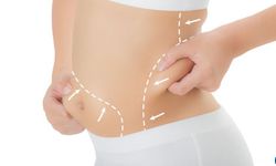 Liposuction ile Fazla Yağlardan Hızla Kurtulun