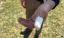 Parkta gezerken Pitbull saldırısına uğradı...