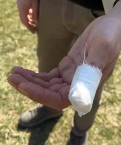 Parkta gezerken Pitbull saldırısına uğradı...