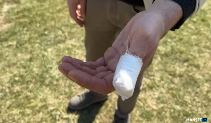 Parkta gezerken Pitbull saldırısına uğradı...